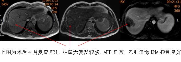 2016111109511800.jpg