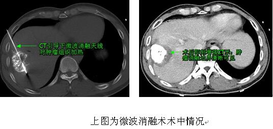2016111109511801.jpg